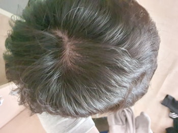 펌 좀 풀리고 나서1