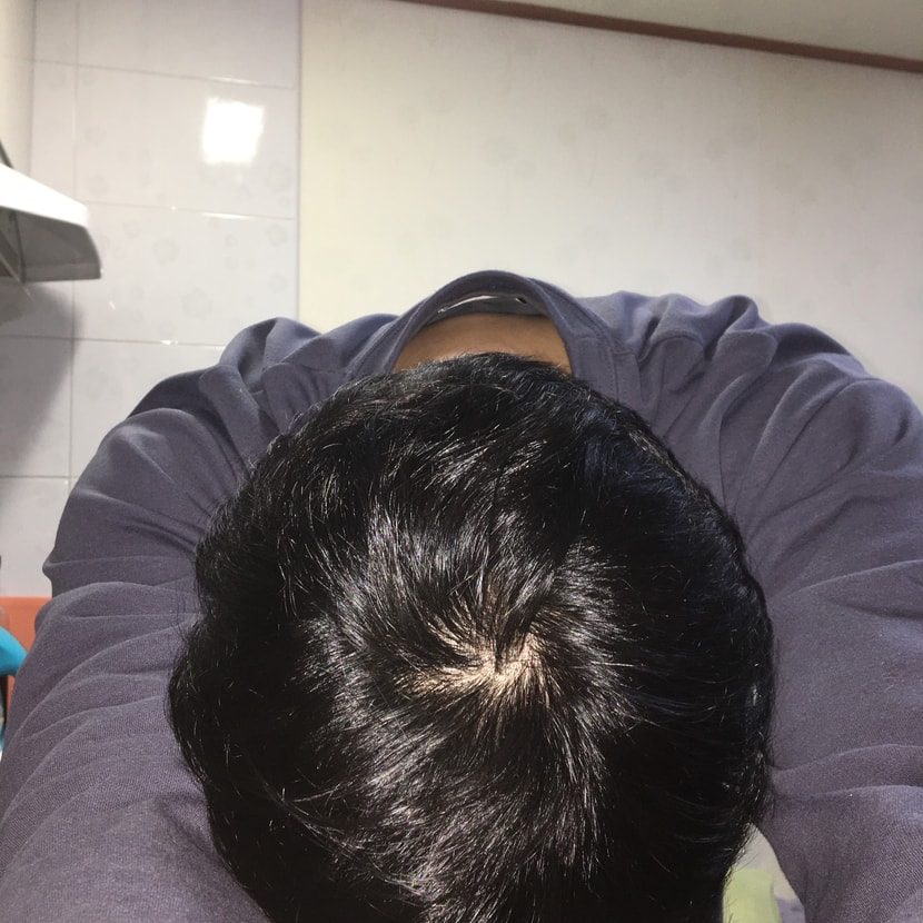 2020 12월25일 후레쉬터트리고