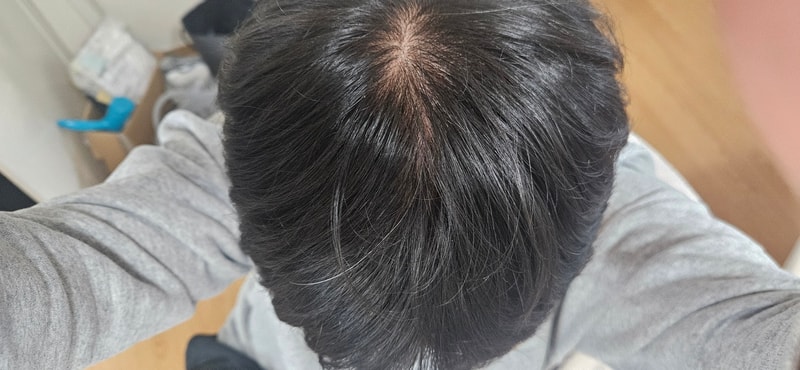 脱毛認証及び質問