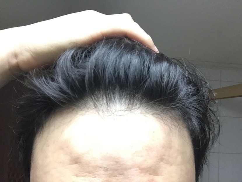 화장실 조명에서 찍은겁니다, 화장실에서 보면 몇가닥 뽑으면 앞머리 없어질것같아보여요.