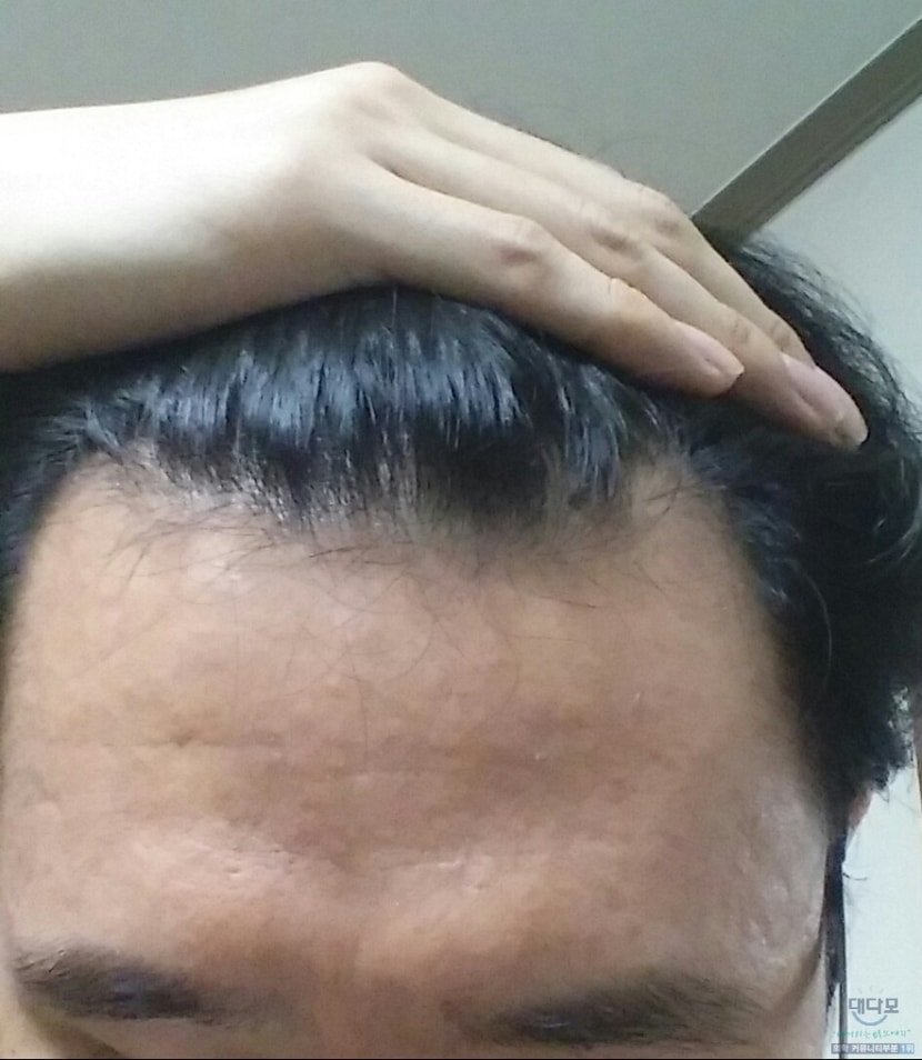 복용전 2