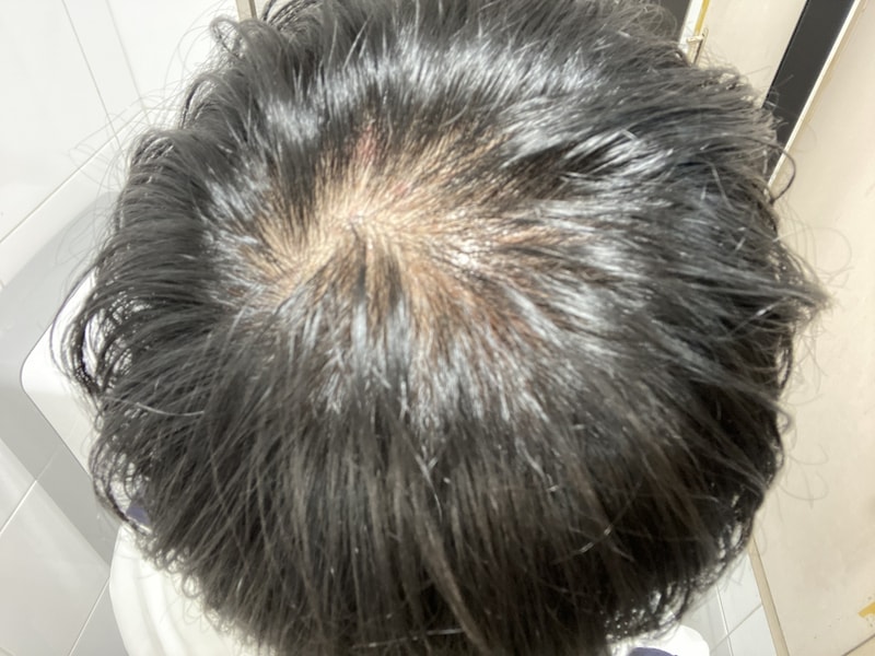 25살 남자인데 진짜 고민입니다ㅠㅠ