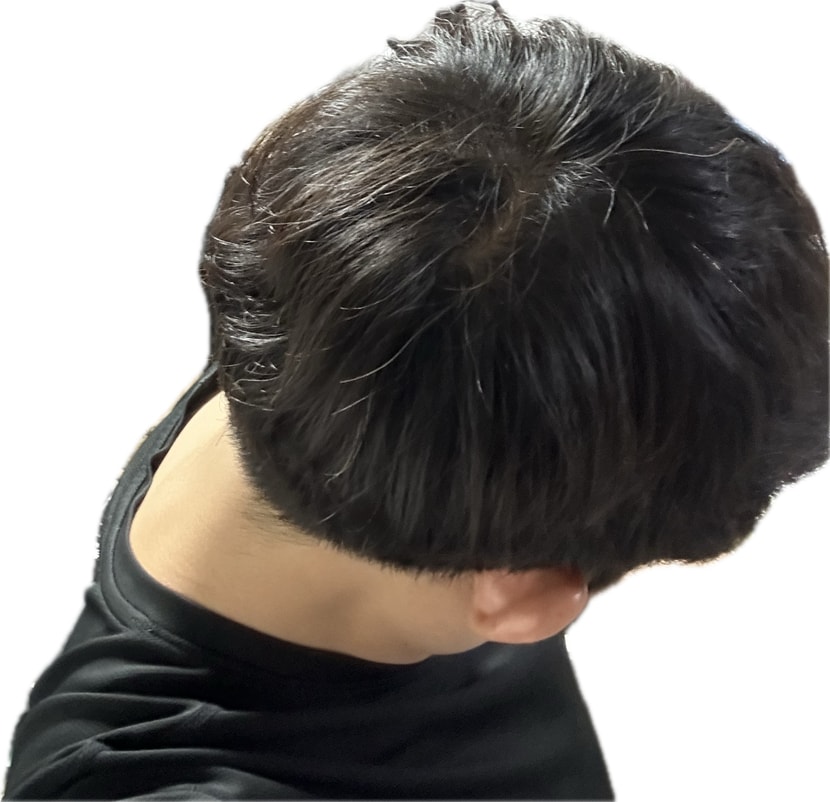 조명 아래 아님