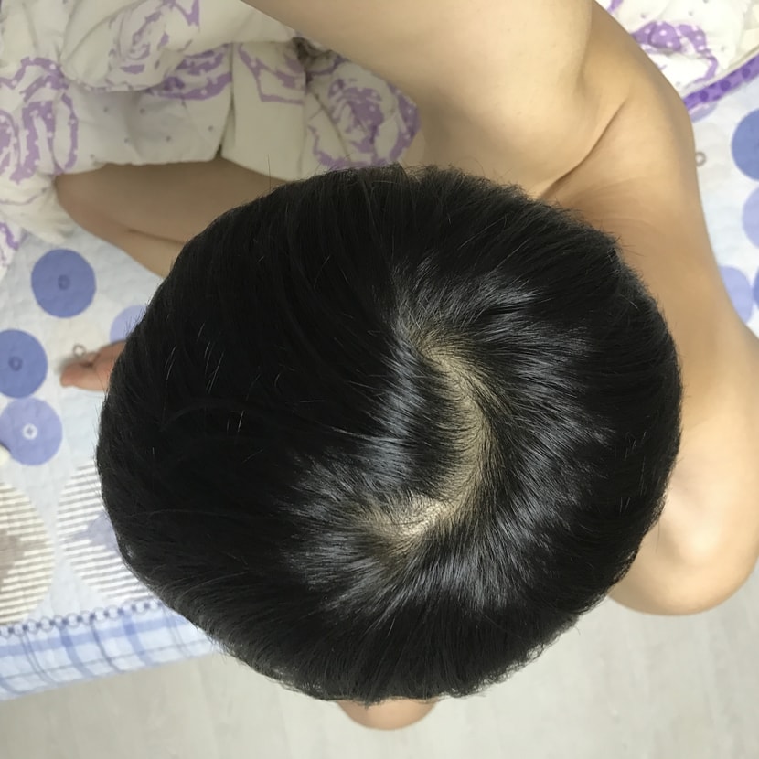 머리를 감고 나서 찍엇습니다. 쌍가마구요 