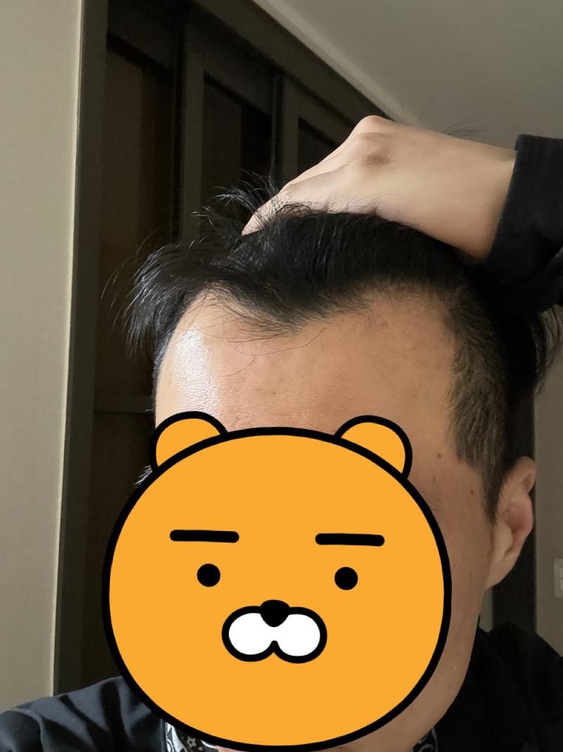 Abodote仅需经过约1年6个月