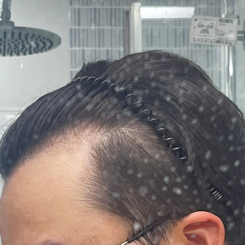오른쪽