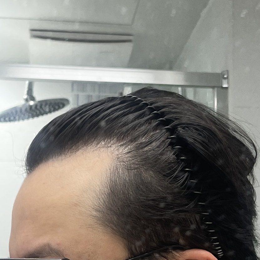 오른쪽