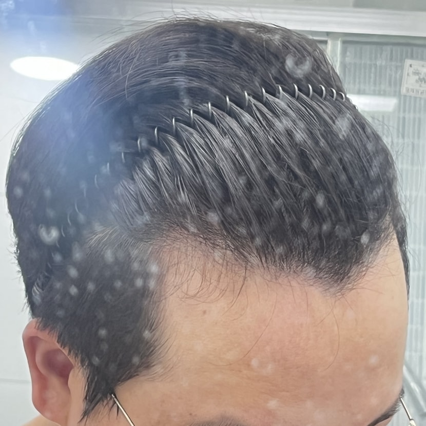 왼쪽 살짝 숙임
