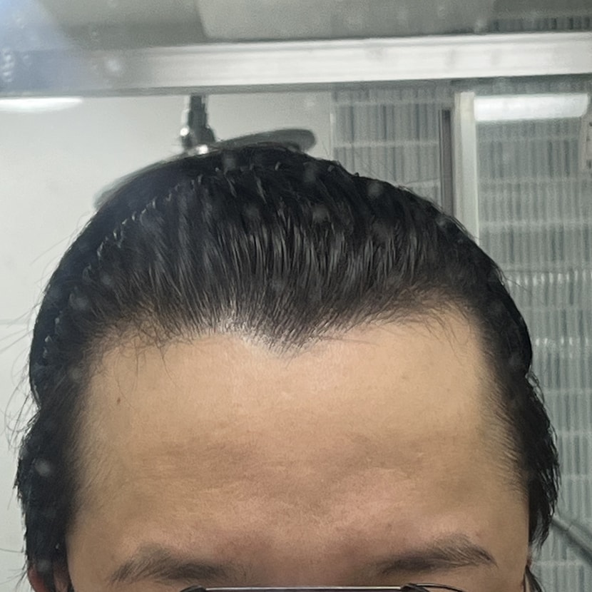 정면