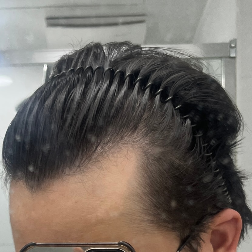 숙인 오른쪽