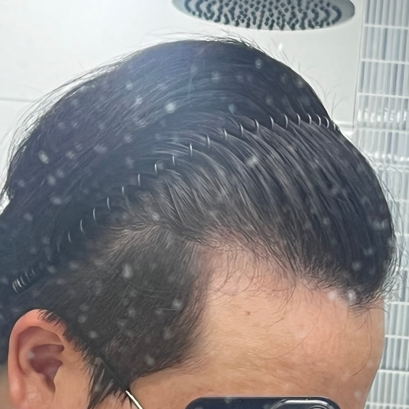왼쪽