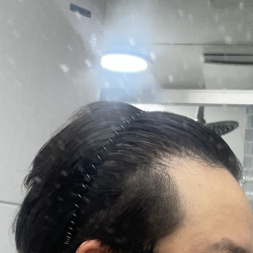 왼쪽