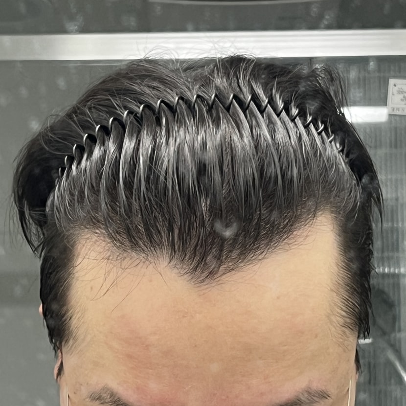 살짝 숙임