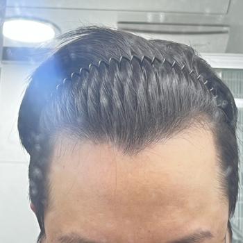 정면