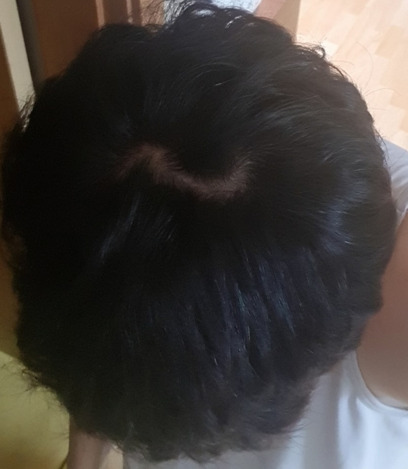 어두운곳