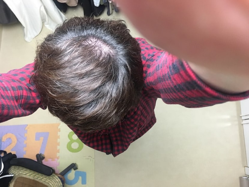35세