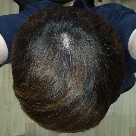 36세2