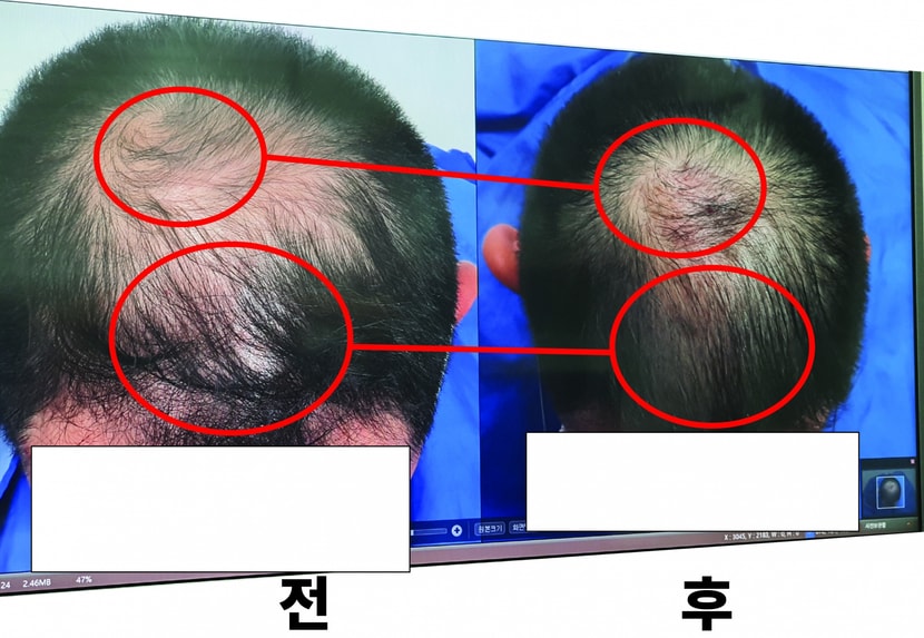 정수리