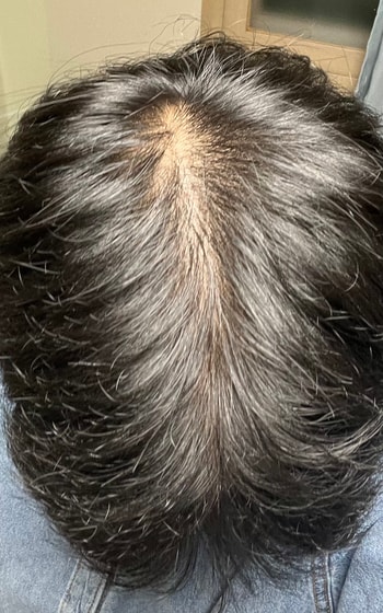 가르마타고 위에서 찍었어요