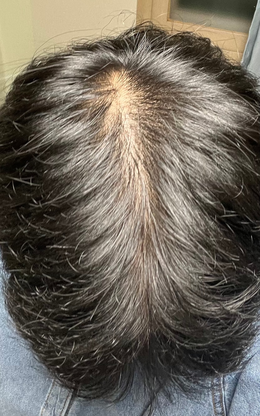 가르마타고 위에서 찍었어요