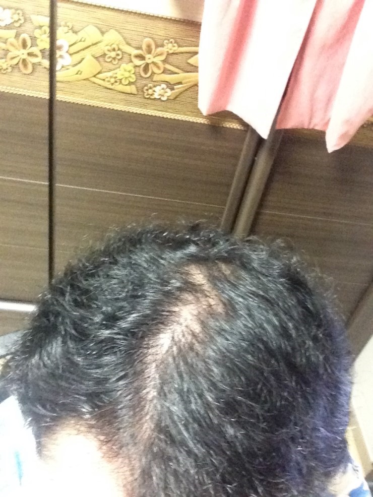 4월 18일