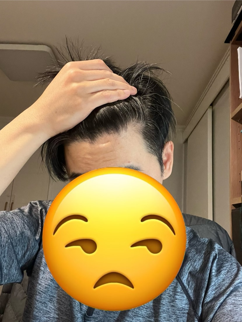 왼쪽