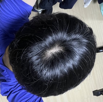 형광등1