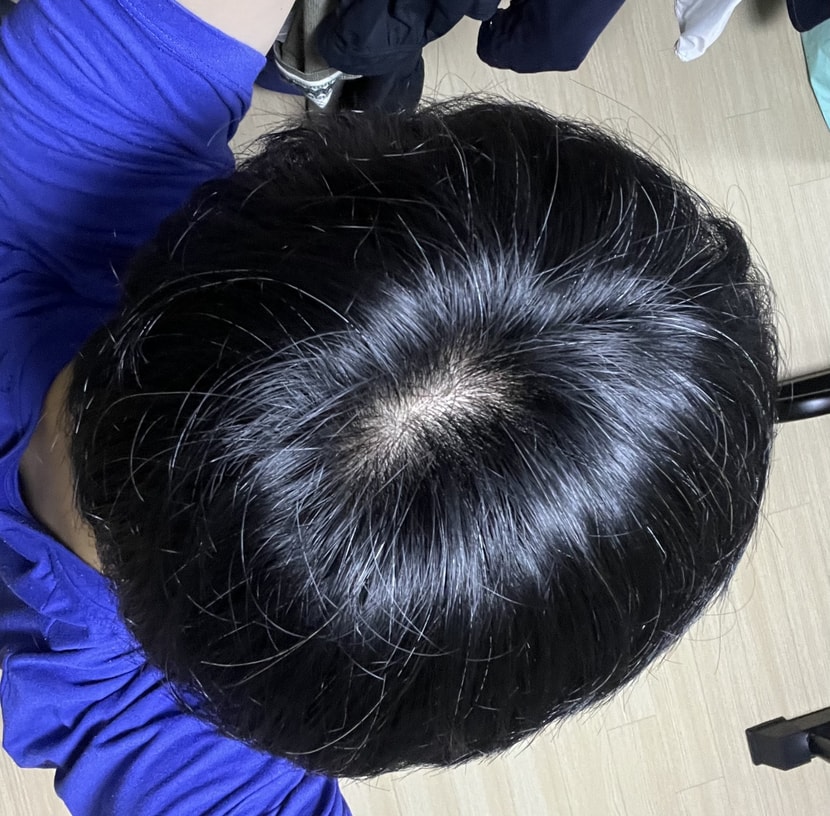 형광등1