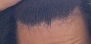 지금 이마입니다
