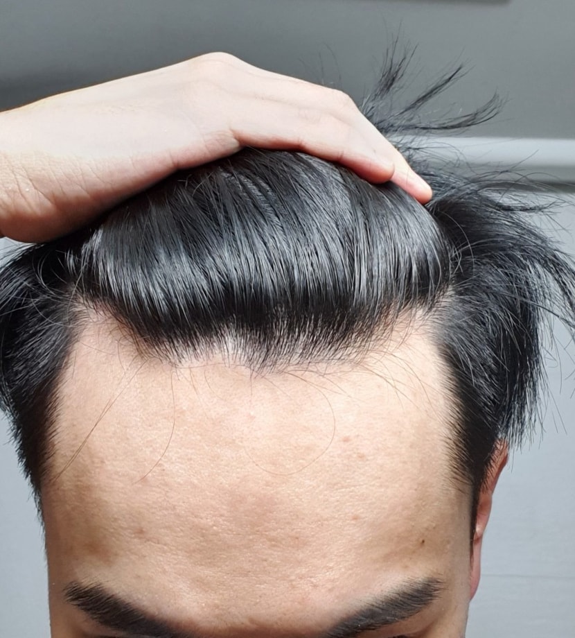 정면