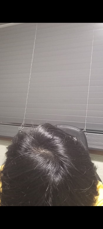 34살 백열등 밑에서 찍은 현재 정수리 사진