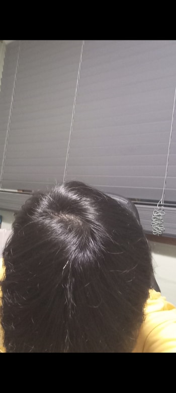 34살 백열등 밑에서 찍은 현재 정수리 사진2