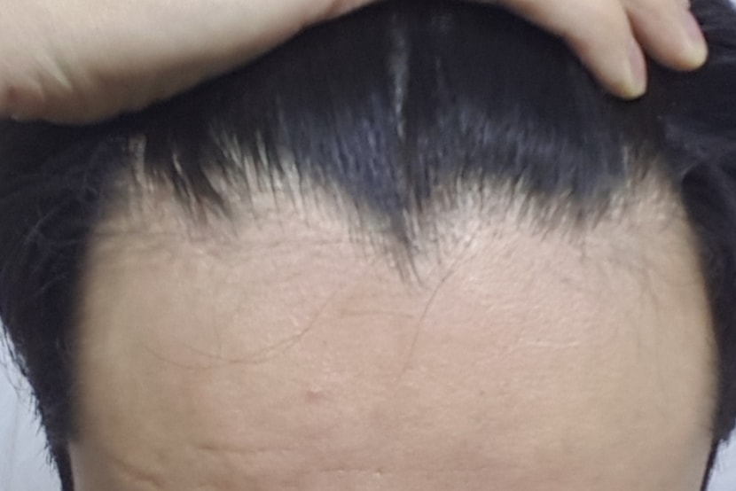 현재