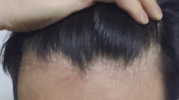 현재