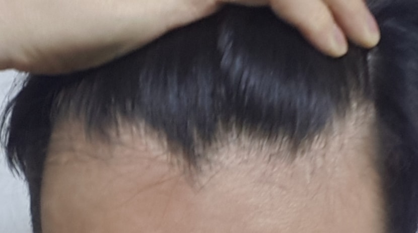 현재