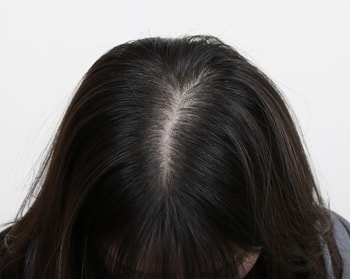 치료후
