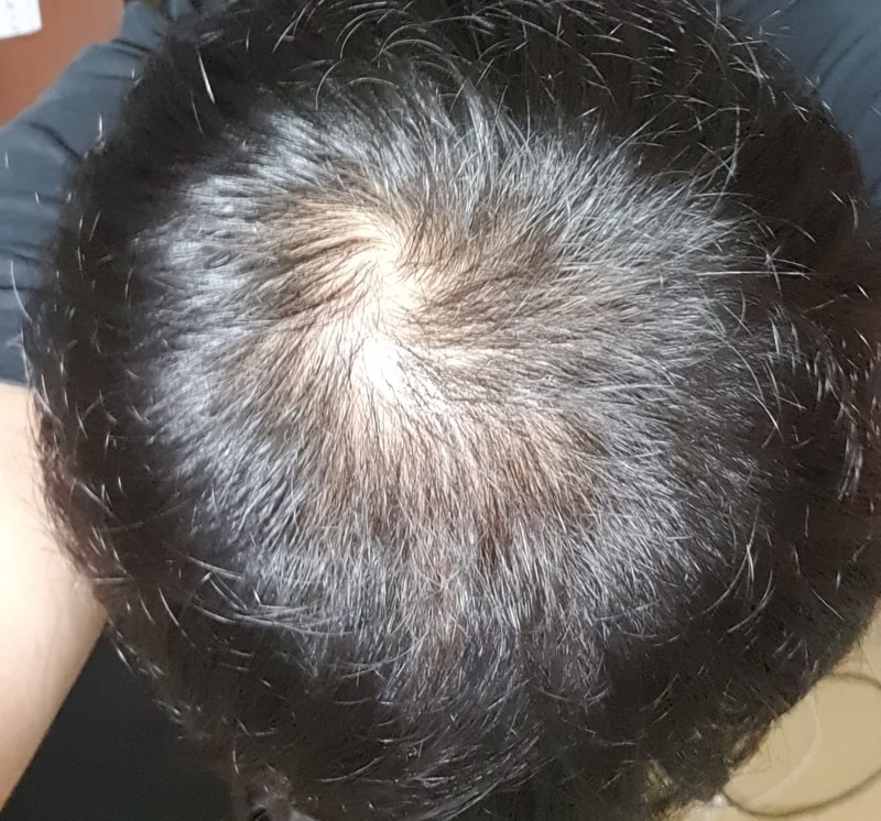 服药后期变化记录