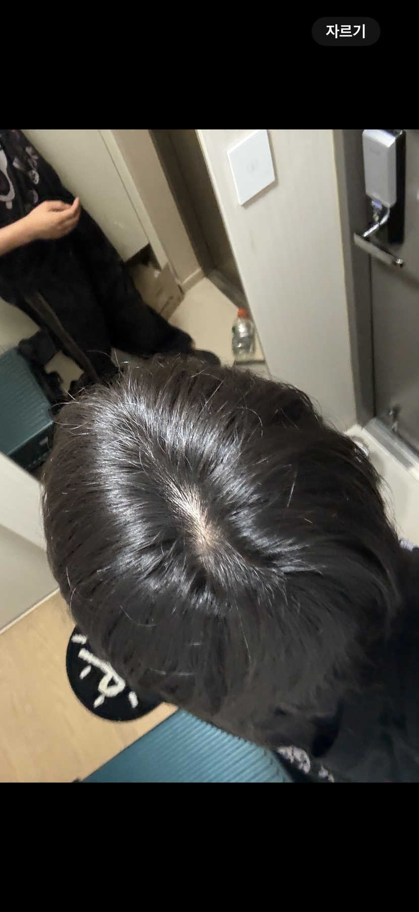 탈모약먹기전