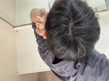 먹은후 20일차