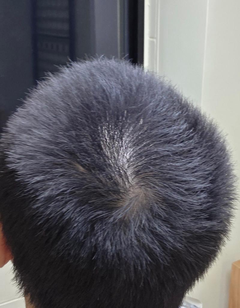 저 정수리 어느정도인가요..?
