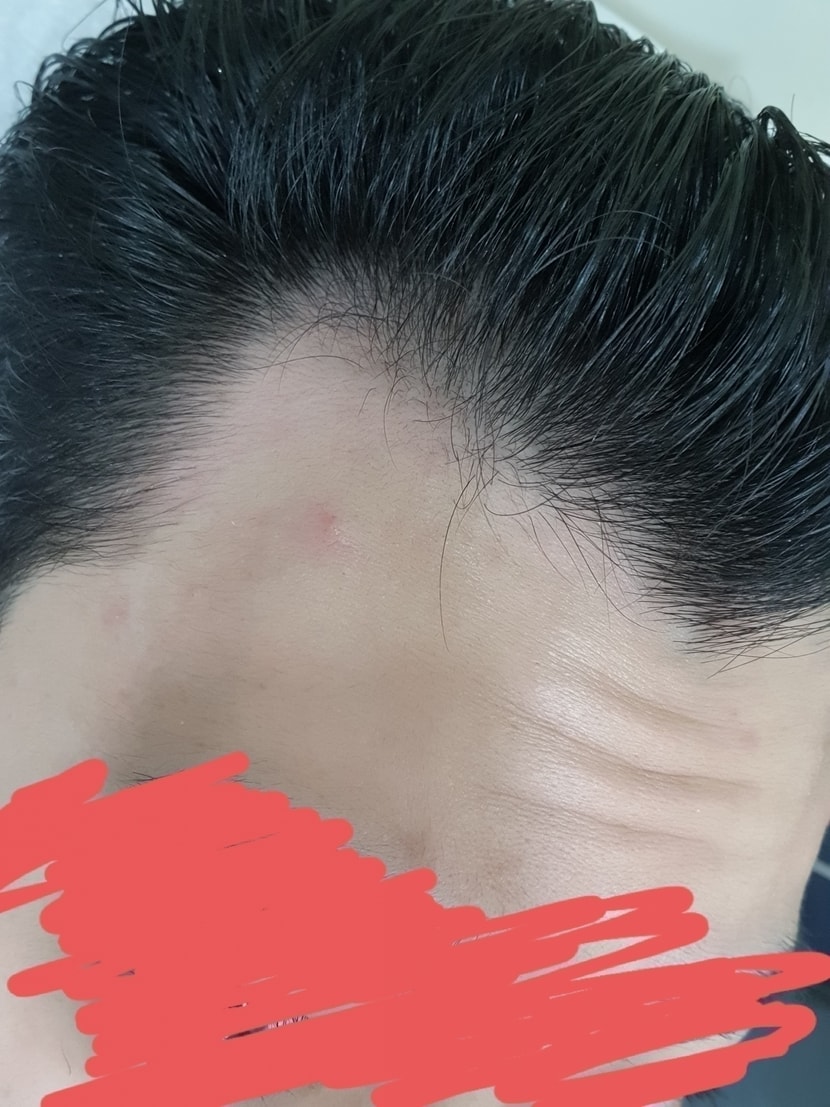 오른쪽