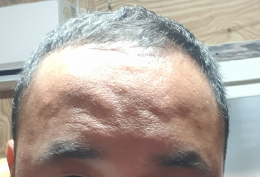관리전 사진입니다 최선의 모발