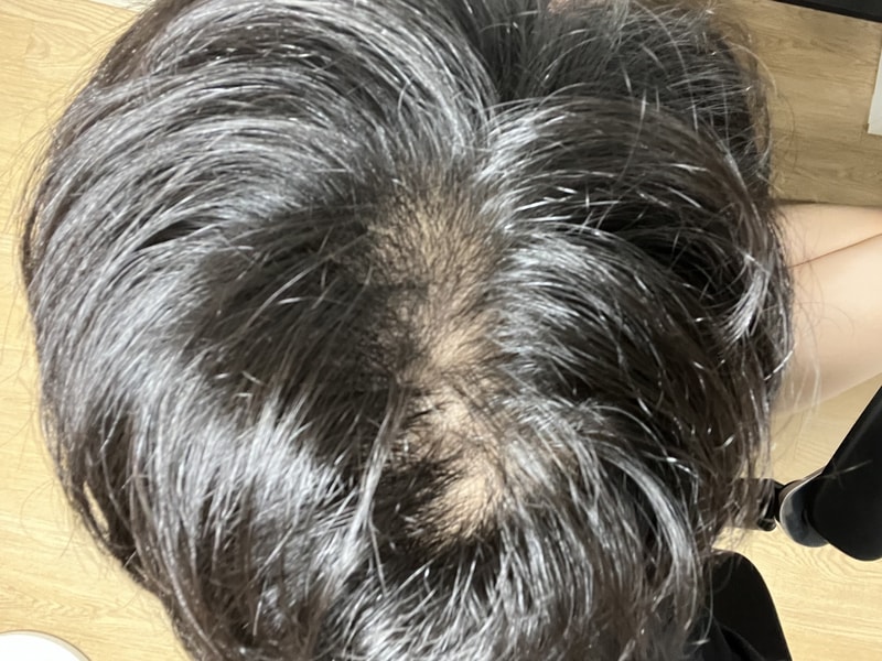 모자쓰고 다닌다음 찍은거긴 한데