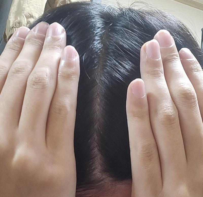 프로페시아 약4년!