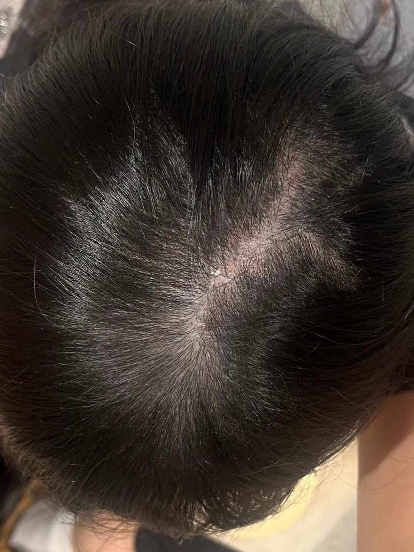 현재 상태......어제 찍은 사진인데 찍고너무 충격받았어요. 나도 내가 이렇게 얇아질줄 몰랐어요.
