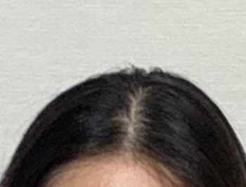 사진만 찍으면 비어보이는 머리가 너무 슬픕니다.