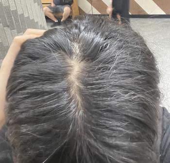 정수리