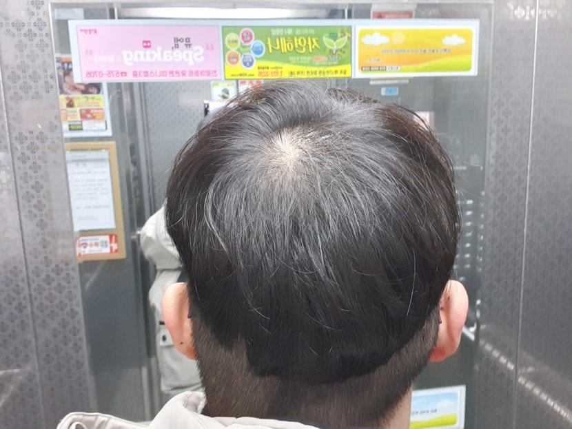 못참고 짜름