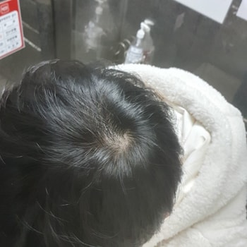 복용후