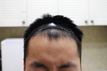 병원에서 찍은겁니다